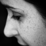 Freckles