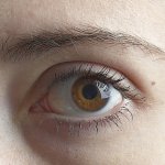The Eye